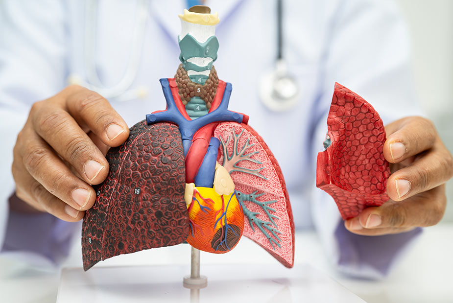 Embolie pulmonaire : causes, symptômes, diagnostic et traitement